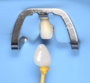 formation dentaire Invisalign go