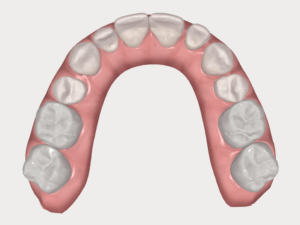 formation dentaire Invisalign go