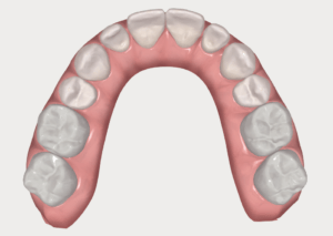 formation dentaire Invisalign go