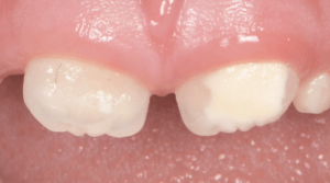 formation dentaire pédodontie